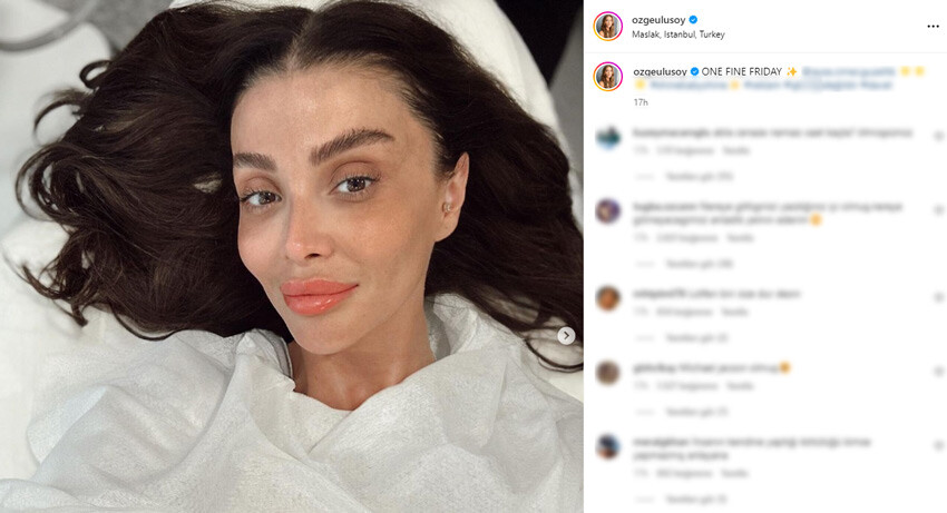 Özge Ulusoy’un güzellik sırrı sosyal medyanın diline düştü! Kimse inanamadı Özge Ulusoy’un güzellik sırrı sosyal medyanın diline düştü! Kimse inanamadı