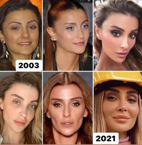 Özge Ulusoy’un güzellik sırrı sosyal medyanın diline düştü! Kimse inanamadı Özge Ulusoy’un güzellik sırrı sosyal medyanın diline düştü! Kimse inanamadı