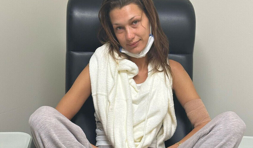 Lyme hastalığı ile mücadele eden Bella Hadid kimsenin görmediği fotoğrafları paylaşıp içini döktü Lyme hastalığı ile mücadele eden Bella Hadid kimsenin görmediği fotoğrafları paylaşıp içini döktü