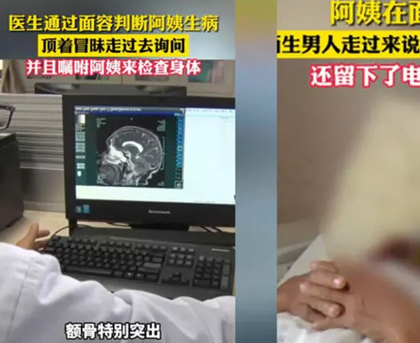 Yabancı biri görünüşüne bakarak teşhis koydu, hayatı kurtuldu: Beyninde ölümcül tümör çıktı