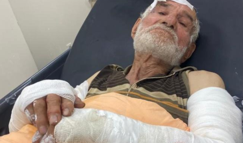 Hem suçlu hem güçlü! 82 yaşındaki adamın bahçesinde koyun otlattı...İtiraz eden adamın 2 kolunu kırdı!