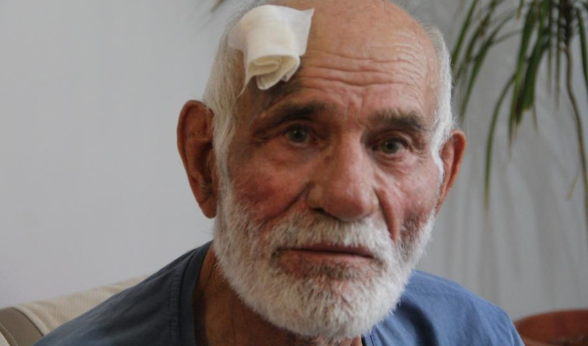 Hem suçlu hem güçlü! 82 yaşındaki adamın bahçesinde koyun otlattı...İtiraz eden adamın 2 kolunu kırdı!