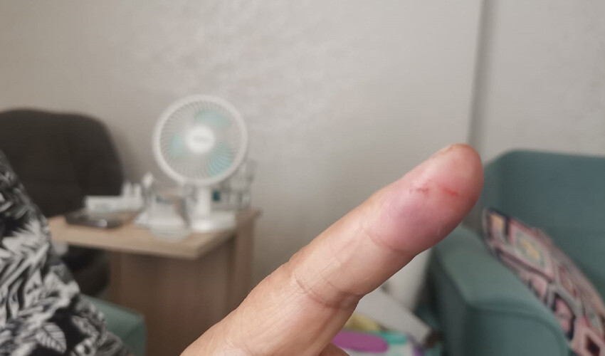 Sokaktaki fare, yaşlı kadını hastanelik etti: Ellerinden kanlar aktı Sokaktaki fare, yaşlı kadını hastanelik etti: Ellerinden kanlar aktı