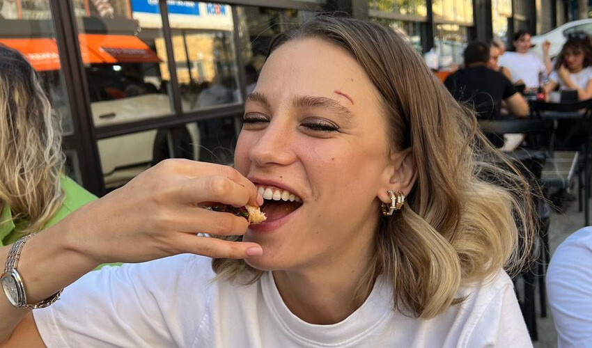 Serenay Sarıkaya’nın kaşındaki yara korkuttu, açıklaması gecikmedi