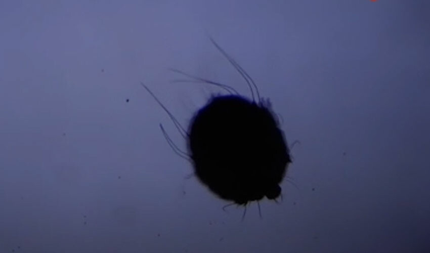 Uyuz bulaştıktan 3 hafta sonra kaşıntılar başlıyor...