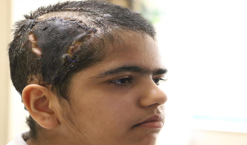 Hava sıcak deyip kask takmadılar! Saçları go-kart tekerine takılan kız, ölümden döndü Hava sıcak deyip kask takmadılar! Saçları go-kart tekerine takılan kız, ölümden döndü