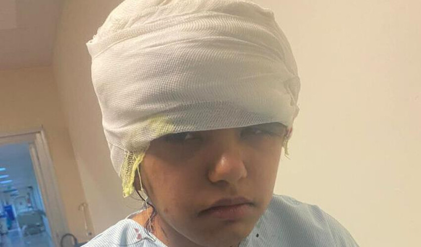 Hava sıcak deyip kask takmadılar! Saçları go-kart tekerine takılan kız, ölümden döndü Hava sıcak deyip kask takmadılar! Saçları go-kart tekerine takılan kız, ölümden döndü