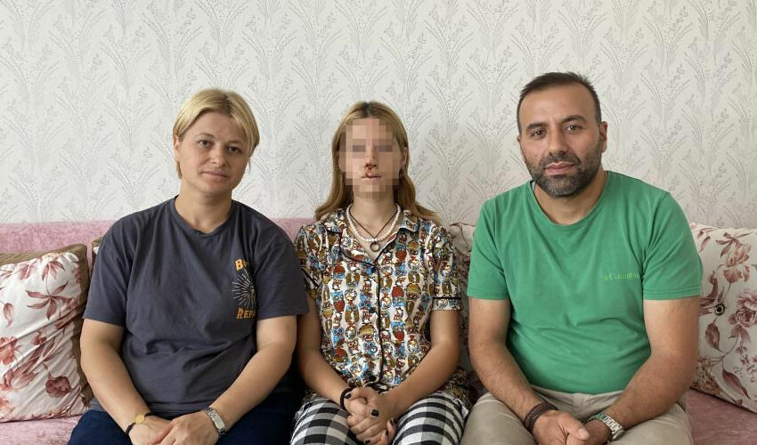 Kaldırım taşı atılan kız ilk kez konuştu: Hayatım karardı, yüzüm değişti Kaldırım taşı atılan kız ilk kez konuştu: Hayatım karardı, yüzüm değişti