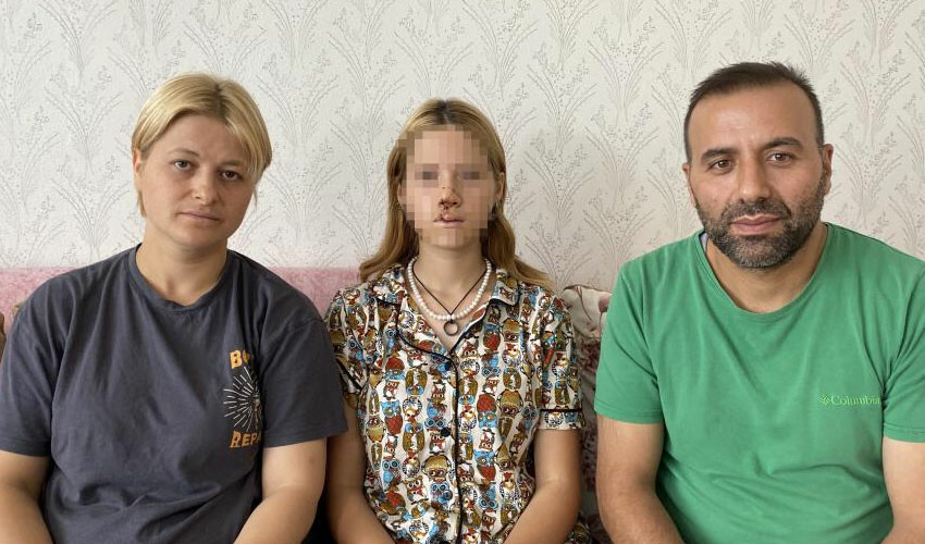 Kaldırım taşı atılan kız ilk kez konuştu: Hayatım karardı, yüzüm değişti Kaldırım taşı atılan kız ilk kez konuştu: Hayatım karardı, yüzüm değişti