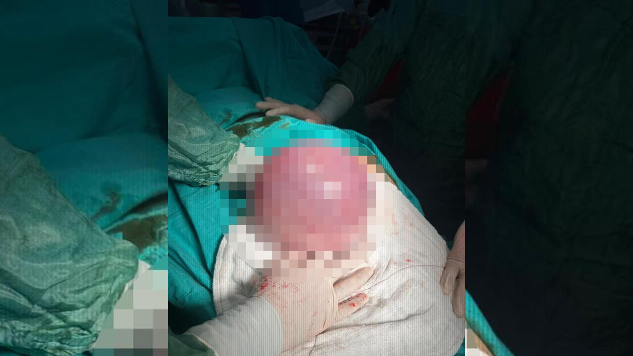 Çektiği acıya dayanamayıp hastaneye gitti, sebebini öğrenince şoke oldu! Dev gibi...