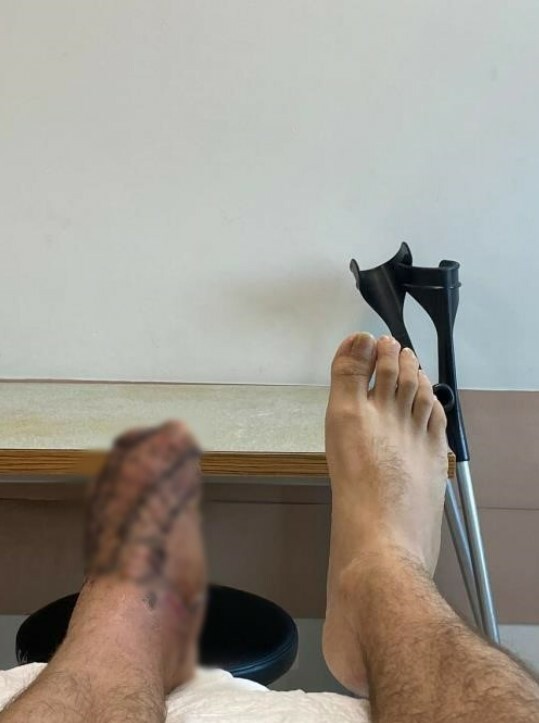 temizlik işçisi ezdi- Celal Sönmez- ayak