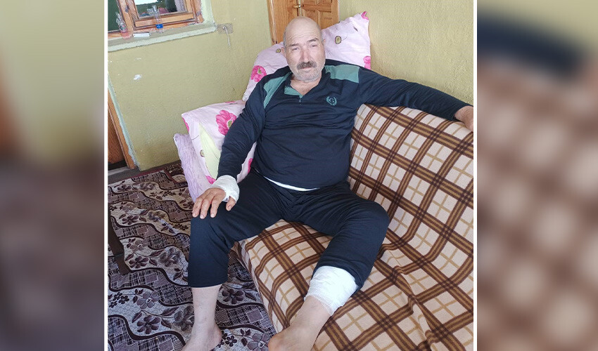Ayının saldırısına uğrayan adam ölümden döndü: Korku dolu anları anlattı ayının saldırdığı adam