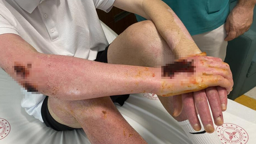 Silivri'de deodorant patlaması