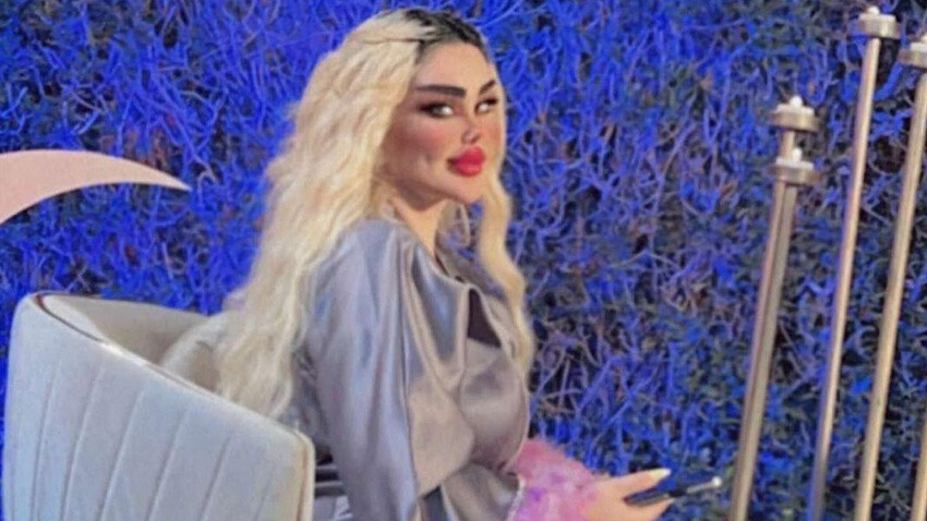 Barbie'ye benzemek istedi, onlarca ameliyat geçirdi: Bir türlü memnun olamayan kadın 44'üncü operasyona hazırlanıyor