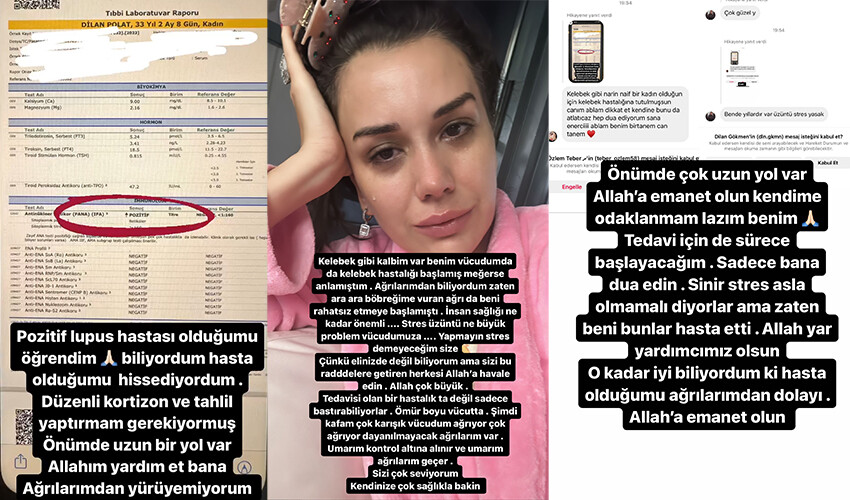 Dilan Polat hastalığını açıkladı: Dayanılmayacak ağrılarım var Dilan Polat hastalığını açıkladı: Dayanılmayacak ağrılarım var