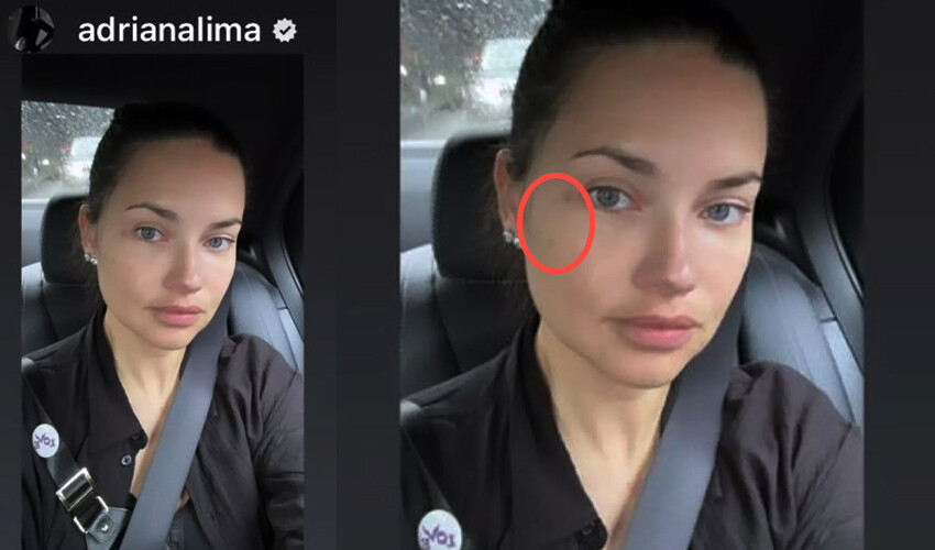 Adriana Lima’nın kabus anları… Lüks otelde tahtakurusu istilasına uğradı Adriana Lima’nın kabus anları… Lüks otelde tahtakurusu istilasına uğradı
