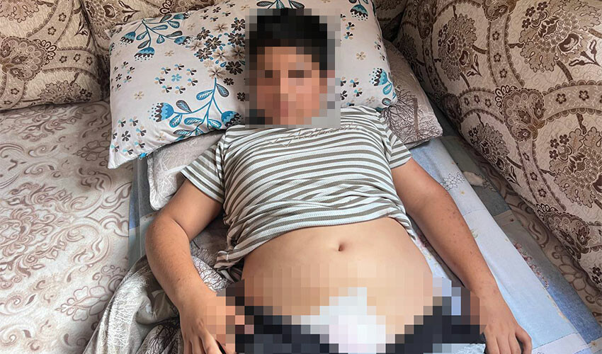 Dehşeti yaşadı! Bisikletli çocuğa başıboş köpek saldırdı