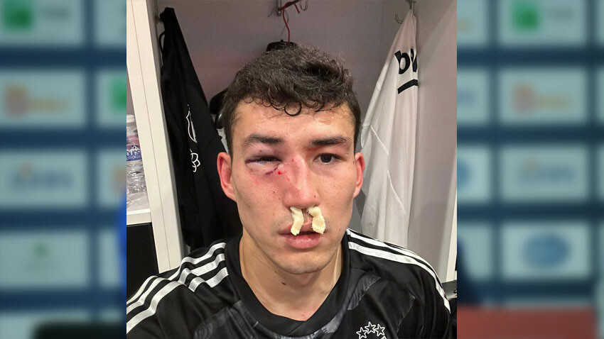 Bahtiyar Zaynutdinov korkuttu! Beşiktaşlı oyuncu hastaneye kaldırıldı Bahtiyar Zaynutdinov korkuttu! Beşiktaşlı oyuncu hastaneye kaldırıldı