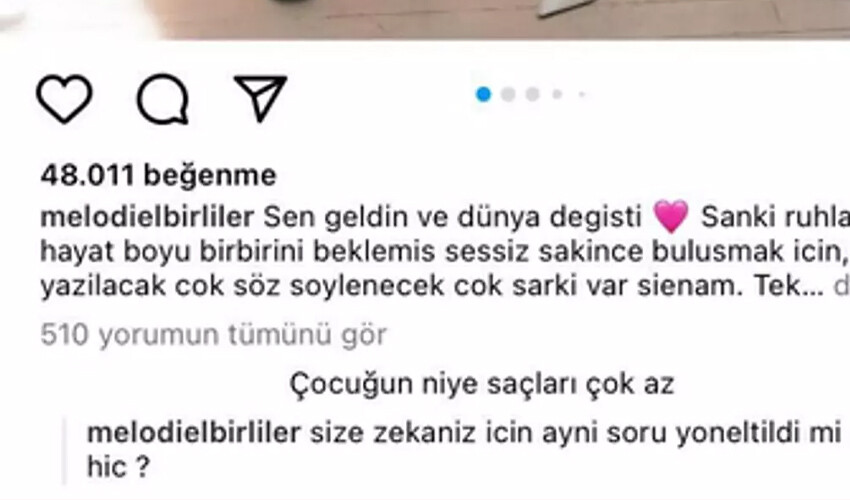 Arda Türkmen’in eşi Melodi Elbirliler kızına yapılan yoruma dayanamadı! Tokat gibi cevap…