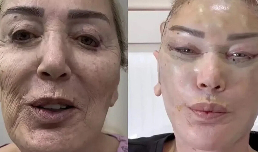 Seda Sayan ablasına da estetik yaptırdı! Son halini gören şoke oluyor Seda Sayan ablasına da estetik yaptırdı! Son halini gören şoke oluyor