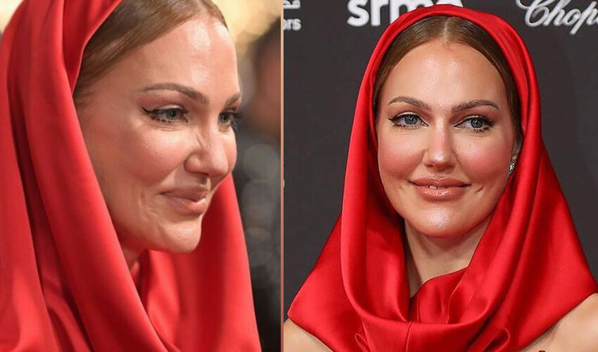Estetik kurbanı olan Meryem Uzerli mimik yapamaz hale geldi Estetik kurbanı olan Meryem Uzerli mimik yapamaz hale geldi