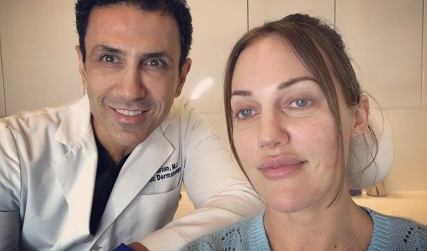 Estetik kurbanı olan Meryem Uzerli mimik yapamaz hale geldi Estetik kurbanı olan Meryem Uzerli mimik yapamaz hale geldi