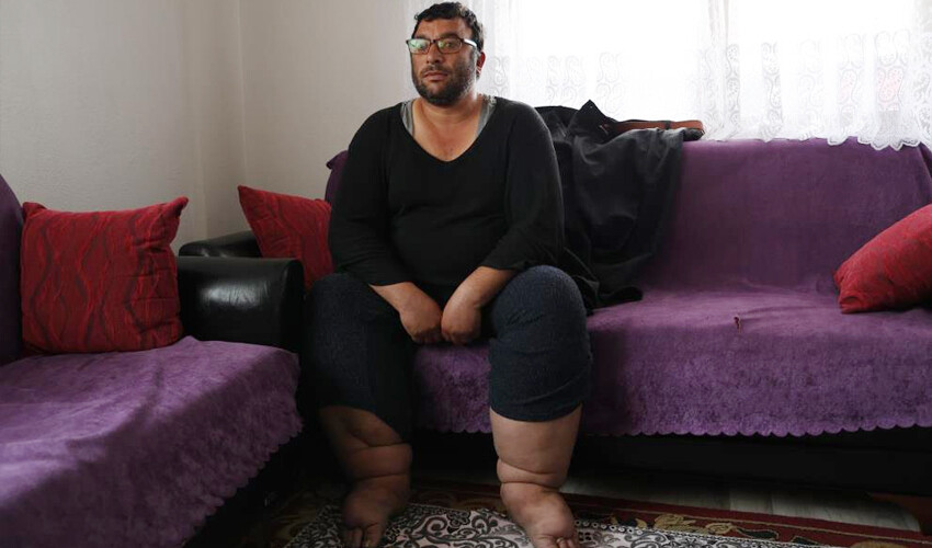 Karıncalanma şikayetiyle gitti, gerçeği öğrenince hayatı alt üst oldu