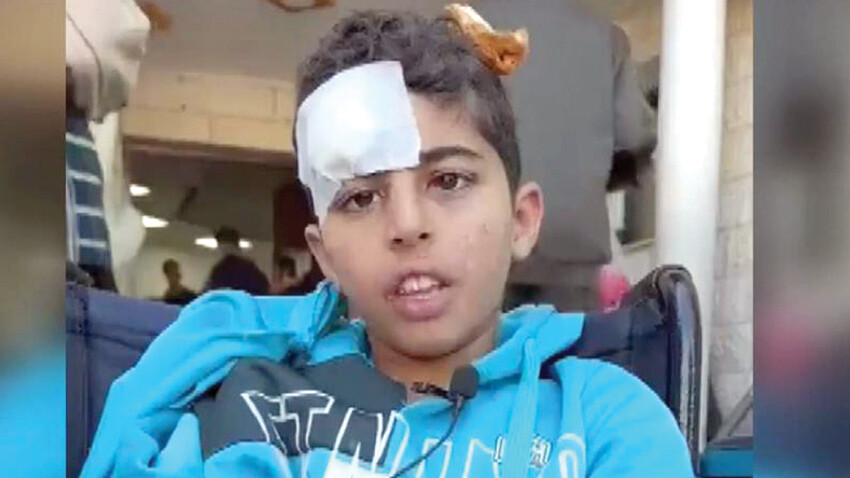 Gazze'nin imdadına Türkiye yetişti! Sahra hastanesi için yer bulundu