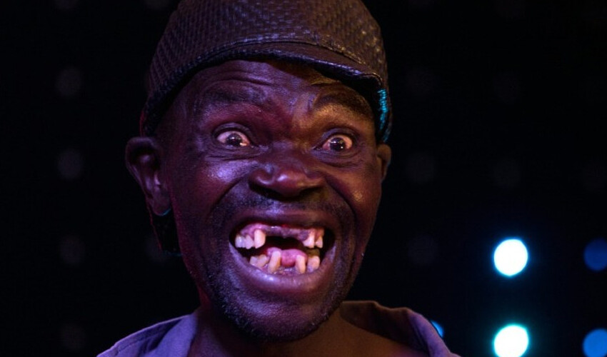 ‘Dünyanın en çirkin insanı’ ölü bulundu