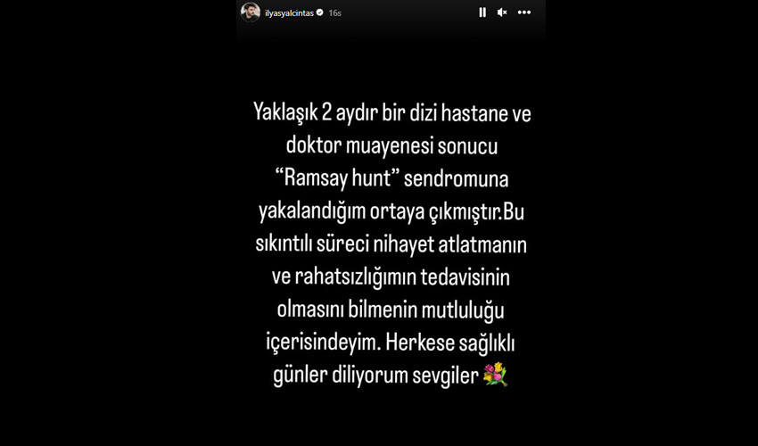 Şarkıcı İlyas Yalçıntay ‘Ramsay Hunt’ sendromuna yakalandığını açıkladı