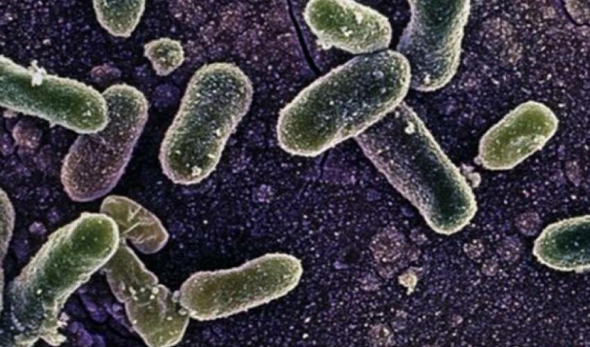 Kavun yerken bir kere daha düşünün! 8 kişi hayatını kaybetti, yüzlerce kişi hastaneye kaldırıldı Kavun yerken bir kere daha düşünün! 8 kişi hayatını kaybetti, yüzlerce kişi hastaneye kaldırıldı