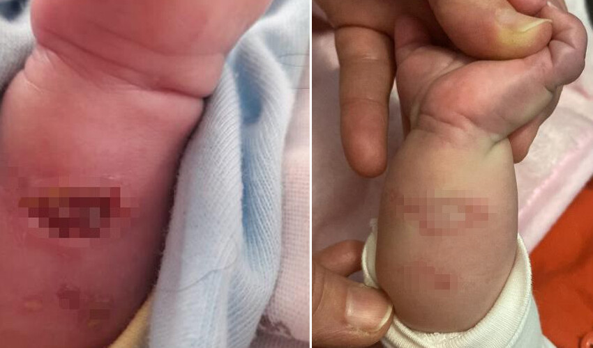 Kahreden olay! Dördüz bebeğinden üçünü kaybetti