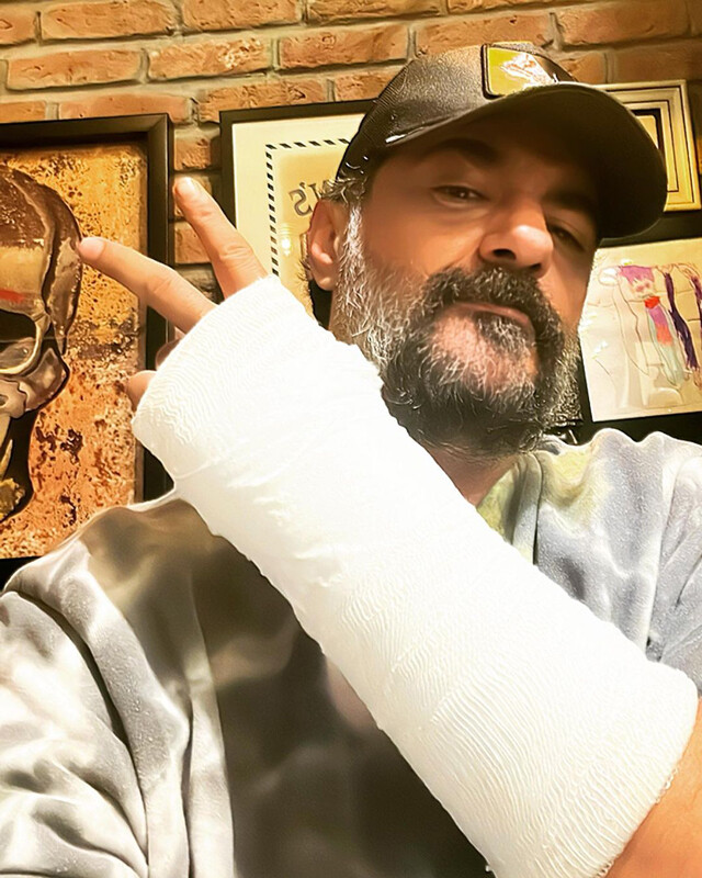 Oyuncu Celil Nalçakan, ‘Kardeşlerim’ dizisi setinde kaza geçirdi Oyuncu Celil Nalçakan, ‘Kardeşlerim’ dizisi setinde kaza geçirdi