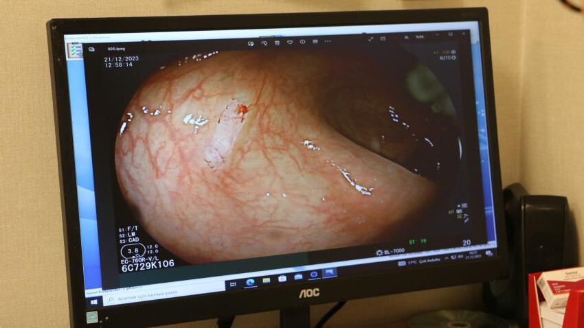 Yutkunma problemiyle gitti, gerçeği hastanede öğrendi! 3 kişiden 1’i risk altında… Yutkunma problemiyle gitti, gerçeği hastanede öğrendi! 3 kişiden 1’i risk altında…