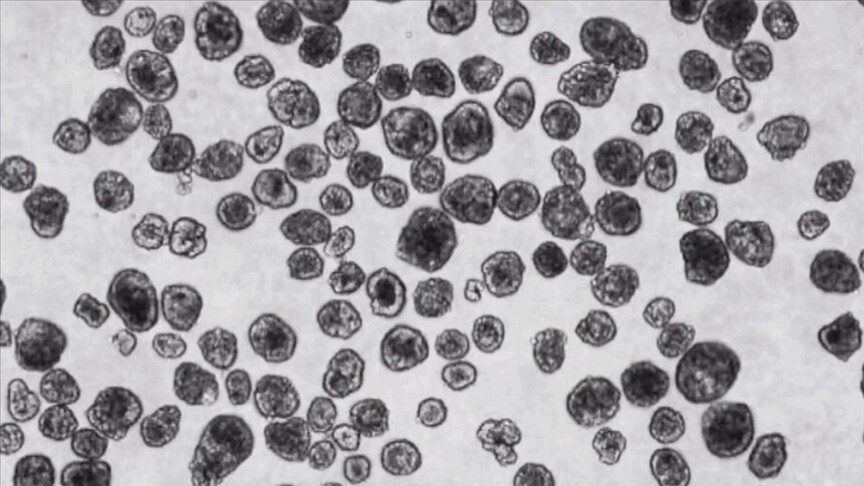 Türk bilim insanından cığır açan buluş! İnsan hücrelerinden canlı robot üretti Türk bilim insanından cığır açan buluş! İnsan hücrelerinden canlı robot üretti