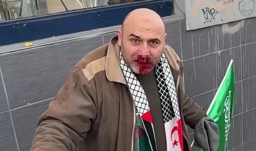 Galata'daki yürüyüşün ardından darbedilen İsmail Aydemir: Bana atılan yumruk Türkiye'deki tüm insanlara atıldı