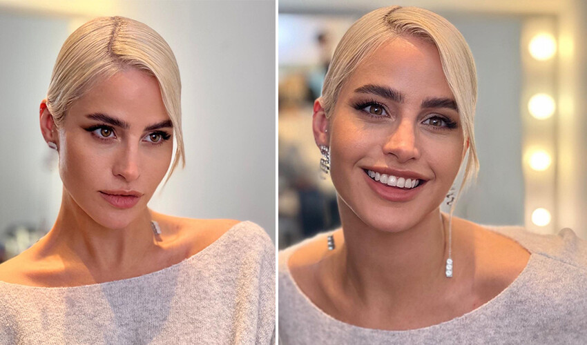 ‘Sadece burnumu yaptırdım’ diyen Büşra Pekin’in son hali gündem oldu! Takipçileri kime benzeteceğini şaşırdı