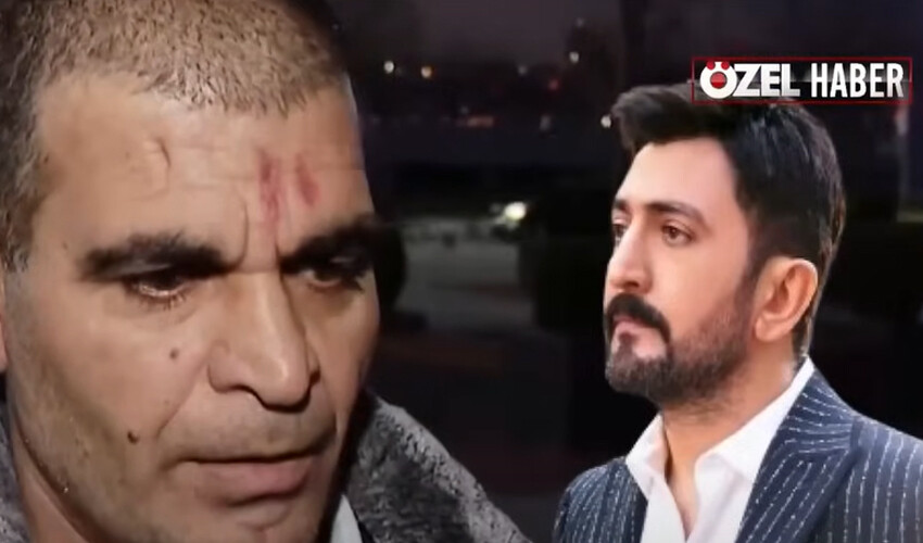 Villasının tadilatını yapan işçileri döven Ferman Toprak gözaltına alındı Villasının tadilatını yapan işçileri döven Ferman Toprak gözaltına alındı