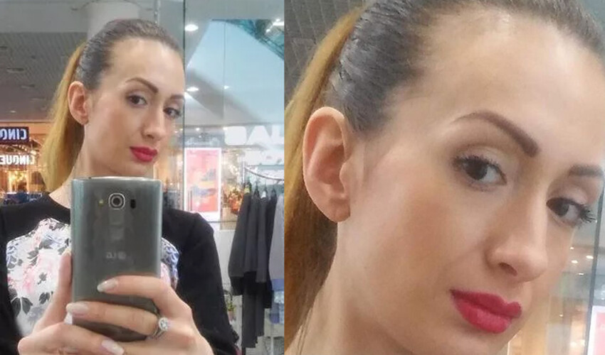 Dünyanın en büyük elmacık kemiklerine sahip kadın eleştirilere cevap verdi