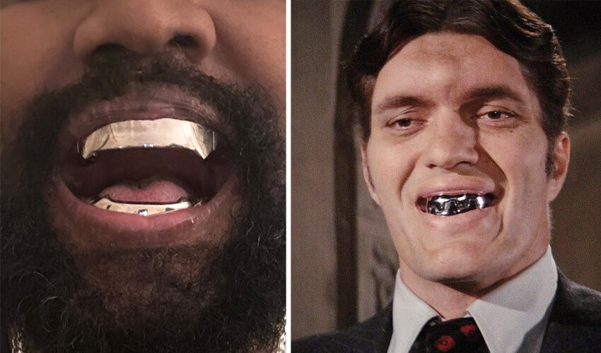 Ağzında artık servet yatıyor… Tüm dişlerini söktüren Kanye West titanyum protez taktırdı