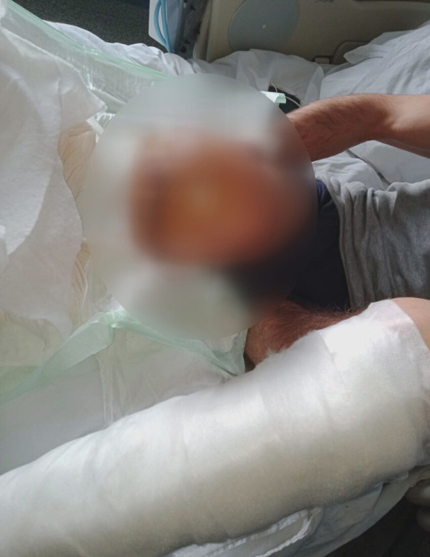 Talihsiz kurye hem bacağından hem 375 bin lirasından oldu