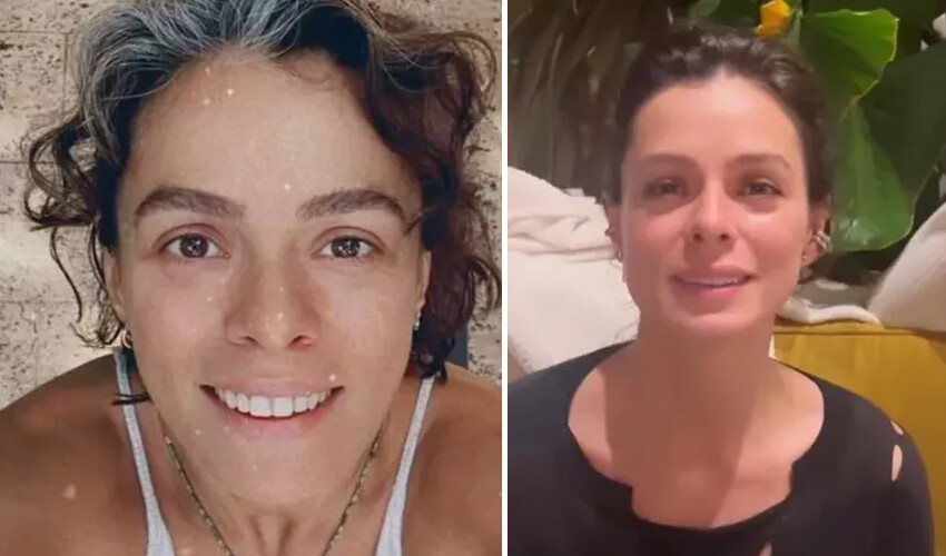 Özge Özpirinçci kural bozdu, dizideki rolü için botoks yaptırdı Özge Özpirinçci kural bozdu, dizideki rolü için botoks yaptırdı