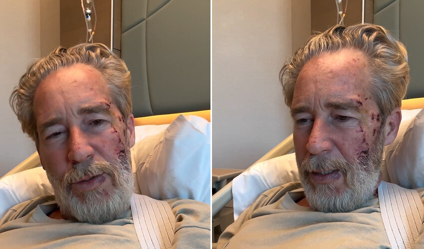 Dizi setinde kaza geçiren Sinan Albayrak’tan haber var! Yara bere içindeki yüzünü paylaştı