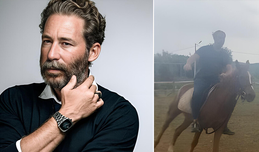 Dizi setinde kaza geçiren Sinan Albayrak’tan haber var! Yara bere içindeki yüzünü paylaştı