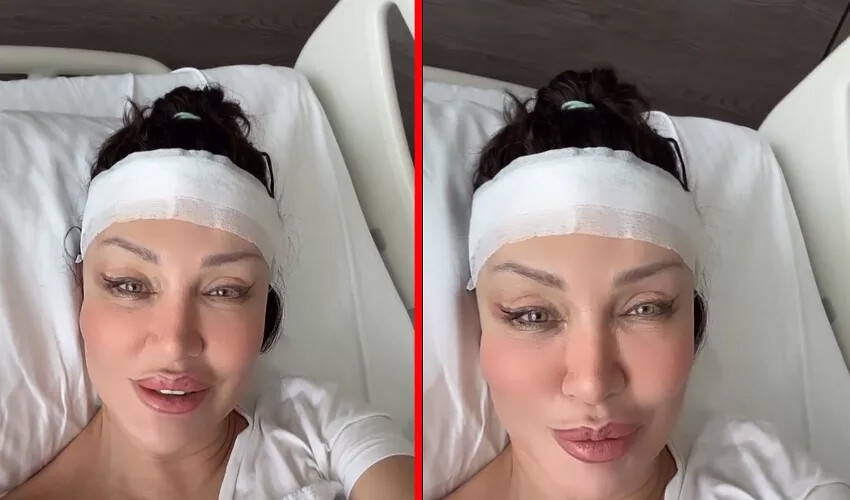 Alın daraltma ameliyatı olan Umut Akyürek son halini paylaştı! Dikkat çeken detay… Alın daraltma ameliyatı olan Umut Akyürek son halini paylaştı! Dikkat çeken detay…