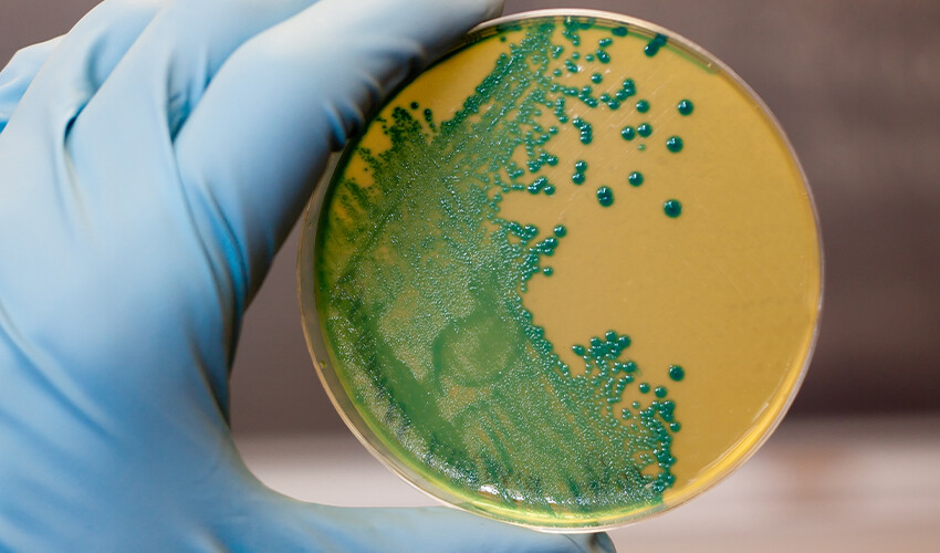 Yüksek ateş şikayetiyle hastaneye kaldırıldı, kalbinde ‘gizemli bakteri’ bulundu