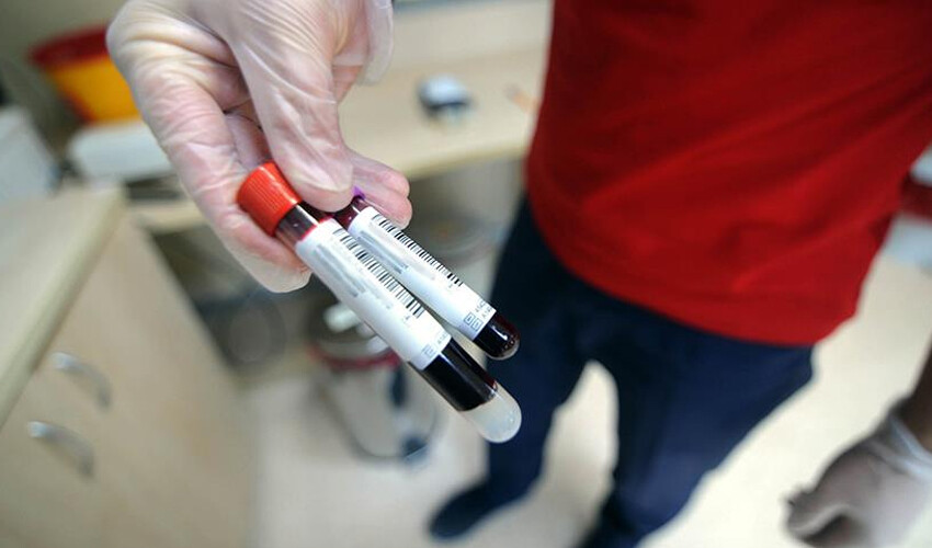 Çok üşüyorsanız nedeni var: Uzmanı ‘hafife almayın’ deyip uyardı