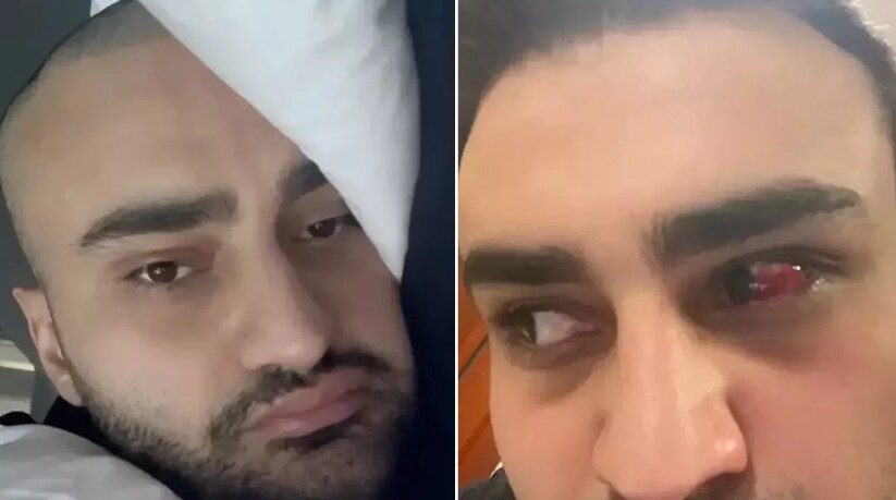 CZN Burak'a ne oldu, neden yaralandı? CZN Burak’ın yaraları neden oldu? CZN Burak'a ne oldu, neden yaralandı? CZN Burak’ın yaraları neden oldu?