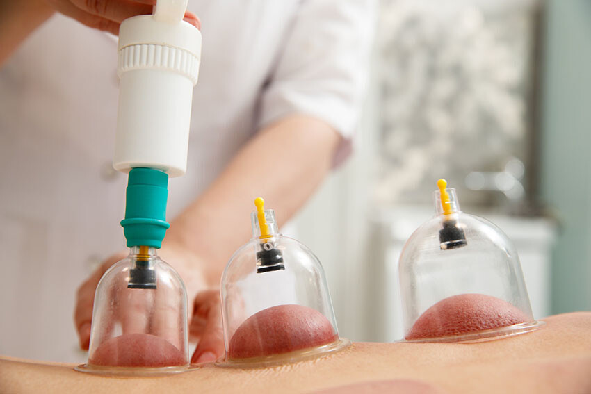 Dünya yıldızları da keşfetti, hacamat vücudun devası