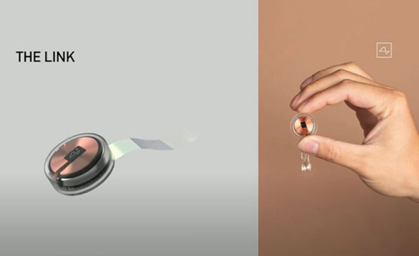 Elon Musk, insan beynine ilk defa çip yerleştirildiğini duyurdu...